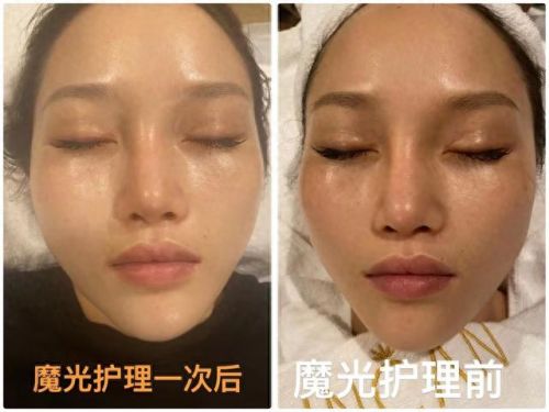 加盟十大美白祛斑排行榜(龙岩祛斑培训免费加盟)