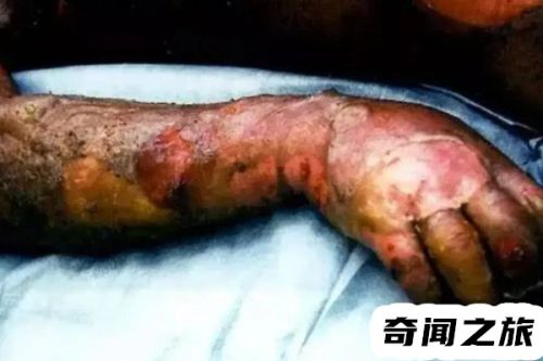 安装工人失误赔偿(工人做外墙保温时不慎失误)插图
