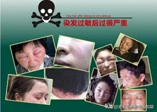 养发馆十大品牌加盟排行榜(养发馆加盟第一品牌排行榜)插图