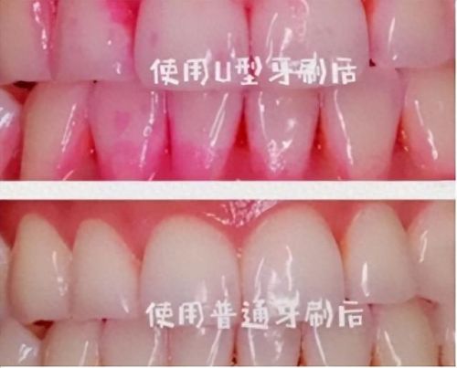 评测儿童牙刷十大排行榜(儿童牙刷推荐老爸评测)插图8