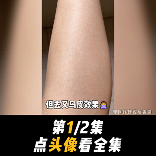 十大脸部平价磨砂膏排行榜(什么牌子脸部磨砂膏好)插图 十大脸部平价磨砂膏排行榜(什么牌子脸部磨砂膏好)插图