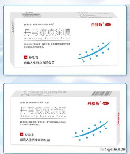 痤疮膏十大排行榜最新(痤疮膏哪些牌药效好)插图2