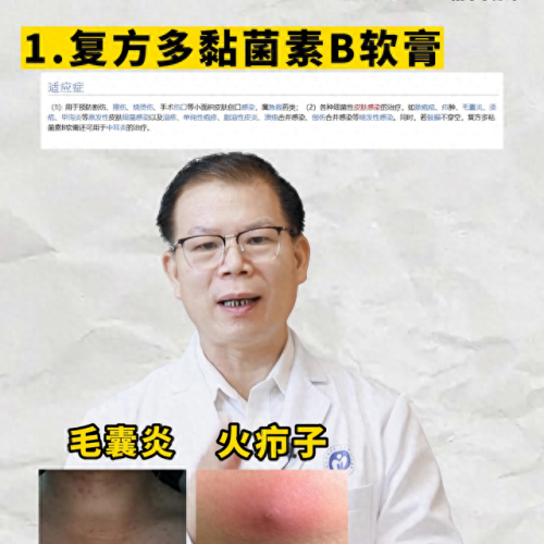 手脚止痒药膏十大排行榜(强力止痒杀菌药膏)插图