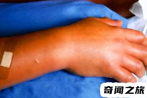安装工人失误赔偿(工人做外墙保温时不慎失误)插图2