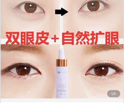 扩眼精油十大排行榜(扩眼精油是不是智商税)插图24