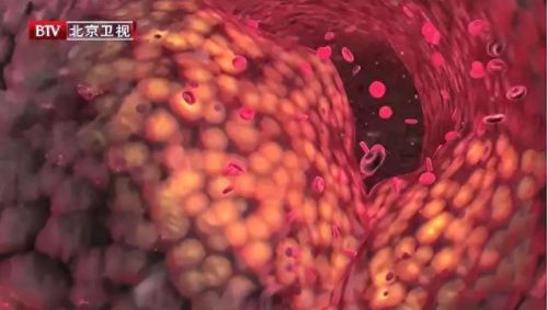 十大胆固醇高食物排行榜(十大低胆固醇食物排名)插图1