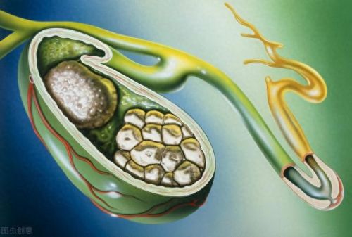 排石中药十大排行榜(化结石最快的茶)插图1