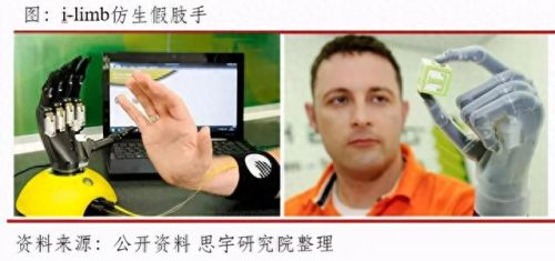 江苏综合假肢排名前十(常州标准假肢排名)插图9