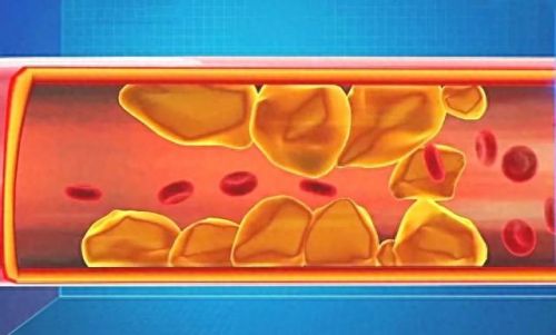 十大胆固醇高食物排行榜(十大低胆固醇食物排名)插图2