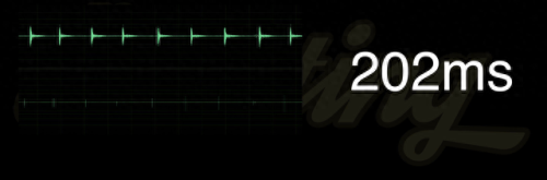 低端蓝牙耳机排名前十(蓝牙监听耳机)插图31 低端蓝牙耳机排名前十(蓝牙监听耳机)插图31