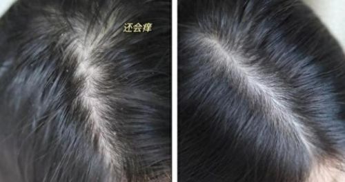 杀菌洗头膏排行榜十大品牌(洗头膏十大品牌排行榜)插图10