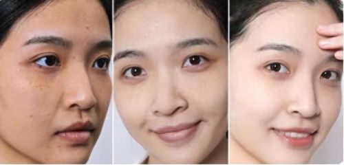 十大祛斑美白产品排行榜(美白祛斑霜第一名国货)插图3