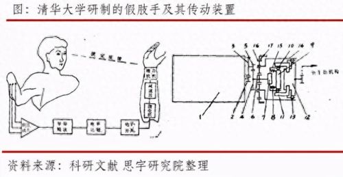 江苏综合假肢排名前十(常州标准假肢排名)插图4