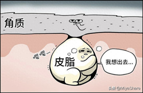 平价美容凝胶排名前十(凝胶的功效与作用)插图2 平价美容凝胶排名前十(凝胶的功效与作用)插图2