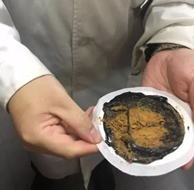 十大口腔溃疡膏药排行榜(能治口腔溃疡的软膏)插图3