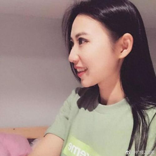 东莞正畸医生排名前十(东莞孙晓玲医生)插图10 东莞正畸医生排名前十(东莞孙晓玲医生)插图10