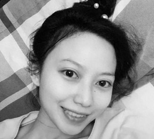 东莞正畸医生排名前十(东莞孙晓玲医生)插图8 东莞正畸医生排名前十(东莞孙晓玲医生)插图8