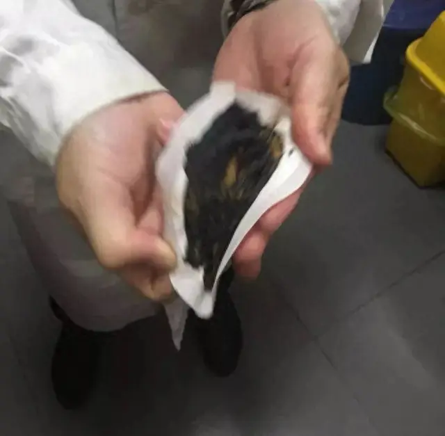 十大口腔溃疡膏药排行榜(能治口腔溃疡的软膏)插图4