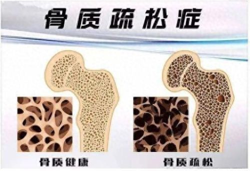 十大男士减肥药排行榜图片(减肥药排行榜有效)插图6