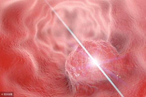 十大癌症排行榜膀胱癌第几(十大治疗癌症的中成药)插图6 十大癌症排行榜膀胱癌第几(十大治疗癌症的中成药)插图6