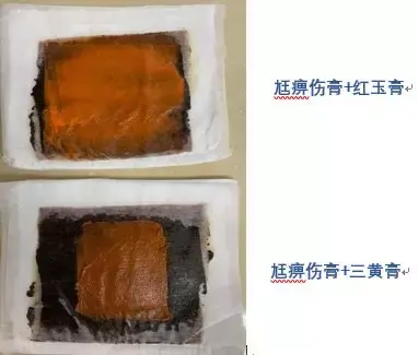 十大口腔溃疡膏药排行榜(能治口腔溃疡的软膏)插图2