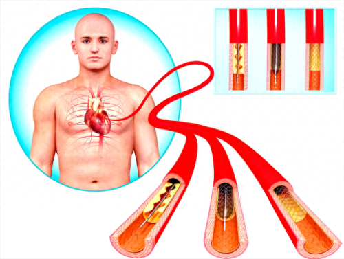 十大营养心肌药品排行榜(营养心肌的药一般用多久)