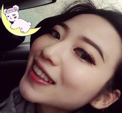 东莞正畸医生排名前十(东莞孙晓玲医生)插图9 东莞正畸医生排名前十(东莞孙晓玲医生)插图9