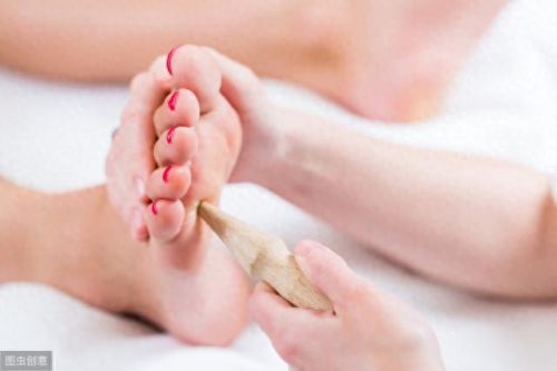 擦脚药膏十大排行榜(祛湿药膏十大排行榜)插图1