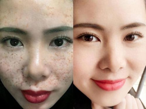 美白液十大排行榜(全脸美白液排行榜)插图4