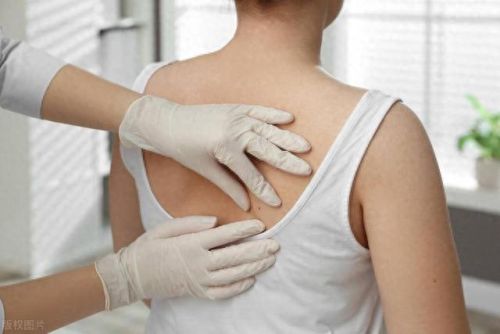 去疤医院排名前十(祛疤医院排行前十)插图9 去疤医院排名前十(祛疤医院排行前十)插图9