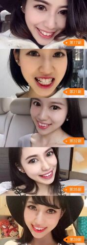 东莞正畸医生排名前十(东莞孙晓玲医生)插图4 东莞正畸医生排名前十(东莞孙晓玲医生)插图4