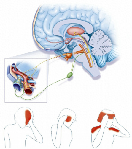头痛药西药十大排行榜(1分钟快速消除头痛)插图 头痛药西药十大排行榜(1分钟快速消除头痛)插图