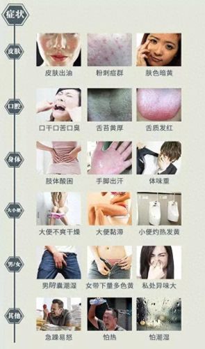 深圳湿气中医排名前十(上海老中医看湿气)插图4 深圳湿气中医排名前十(上海老中医看湿气)插图4