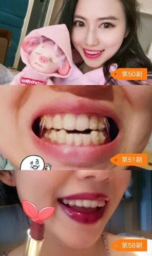 东莞正畸医生排名前十(东莞孙晓玲医生)插图5 东莞正畸医生排名前十(东莞孙晓玲医生)插图5