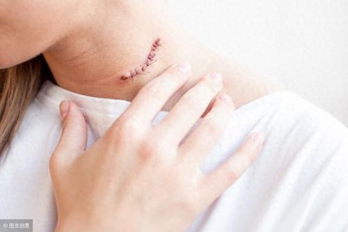 十大癌症排行榜膀胱癌第几(十大治疗癌症的中成药)插图10 十大癌症排行榜膀胱癌第几(十大治疗癌症的中成药)插图10