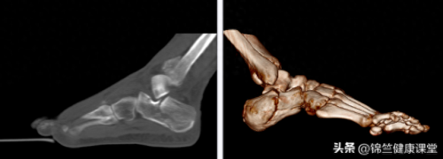 上海颈椎骨科排行榜(上海市颈椎病权威医院)插图