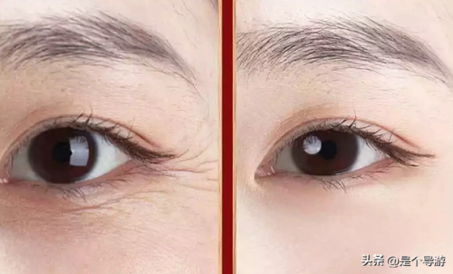 紧肤除皱护肤品排行榜(紧致抗皱效果最好的护肤品)