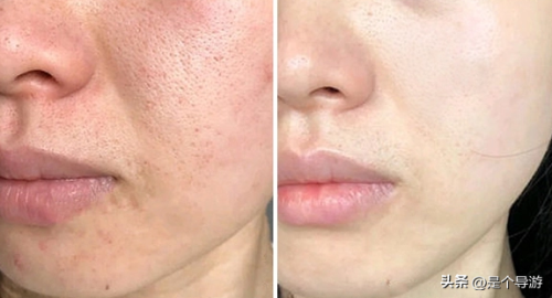 紧肤除皱护肤品排行榜(紧致抗皱效果最好的护肤品)插图1