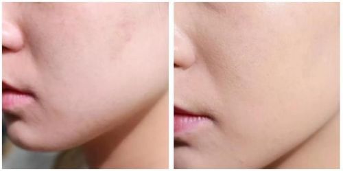 国际粉底液排行榜10强(粉底液十大品牌排行榜)插图34