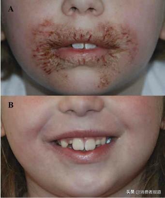 婴幼儿手口湿巾排行榜(最好的婴儿湿巾排名)插图2 婴幼儿手口湿巾排行榜(最好的婴儿湿巾排名)插图2